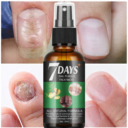 2x1  Endurecedor De Uñas - 7 Days Nails